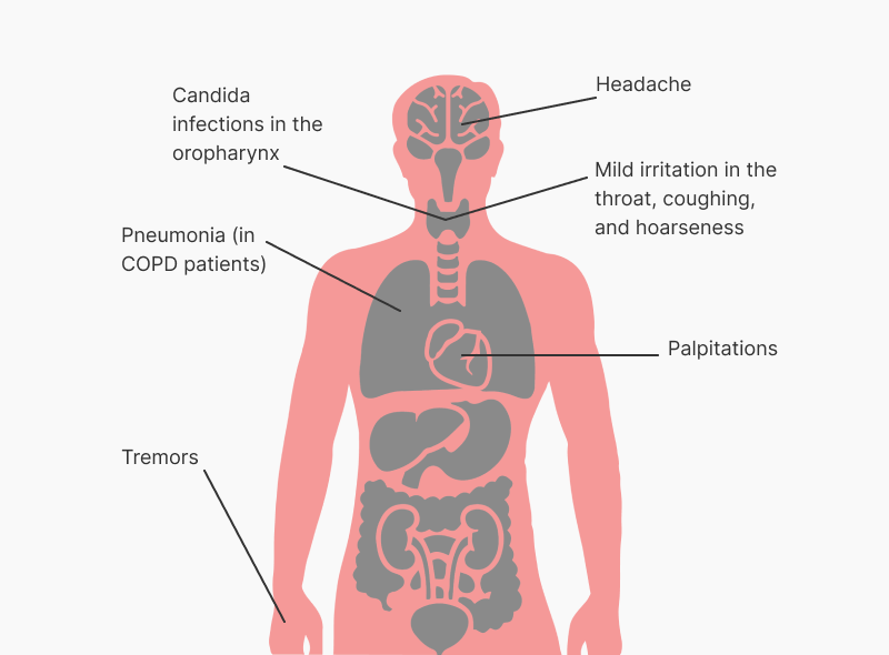 Palpitations, Candida infections in the oropharynx, pneumonia (in COPD patients), headache, tremor, mild irritation in the throat, coughing, and hoarseness